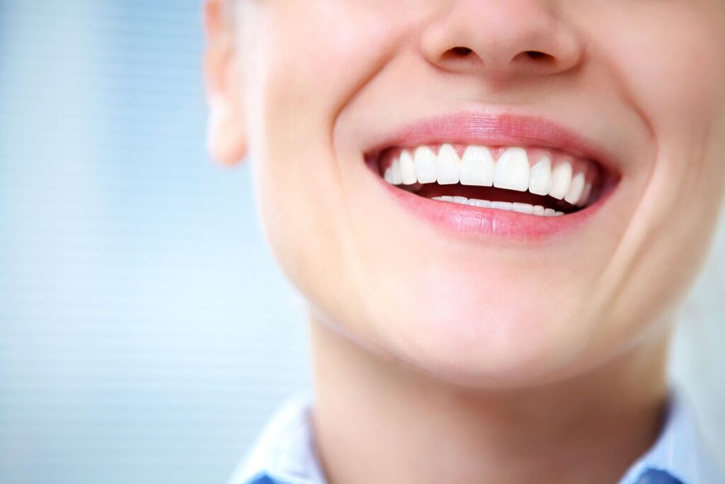 4 Treatments for a Whiter Smile